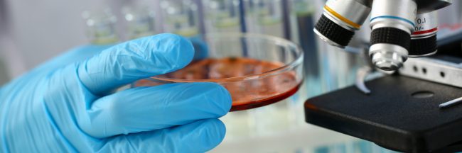 Identifying-Different-Types-of-Mold